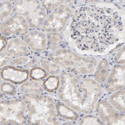 FAM188B Antibody, Novus Biologicals 0.1mL; Unlabeled:Antibodies, Polyclonal